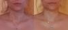 post-2-0-76946400-1475610984_thumb.jpg