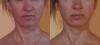 post-2-0-85612300-1475610646_thumb.jpg