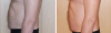 post-47-0-83424700-1450779039_thumb.png