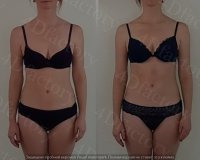 59f63b7b4c859_4899756FB2268115969D021009051BA7E3A6ACAAC8AB7A1F3Bpimgpsh_fullsize_distr.thumb.jpg.9cb23adb3efc4ee574919300eaec57fc.jpg