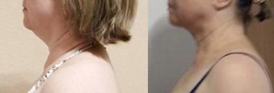 20004.thumb.jpg.be04e8a8a20a5eca1306b2f04eb5f6d2.jpg